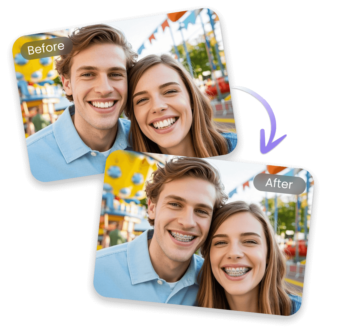 Braces filter for everyone adults teens