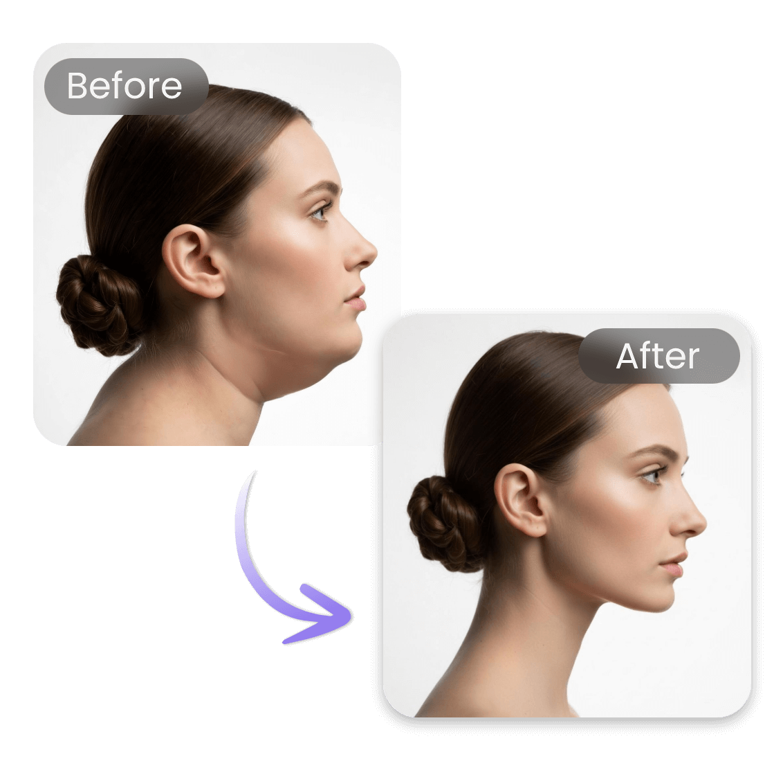 Face slimming with one click skinny filter
