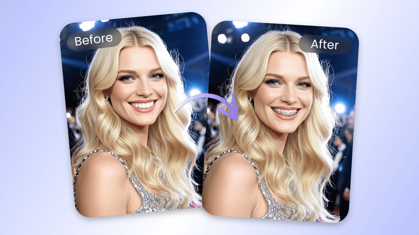 Try braces on celebrities