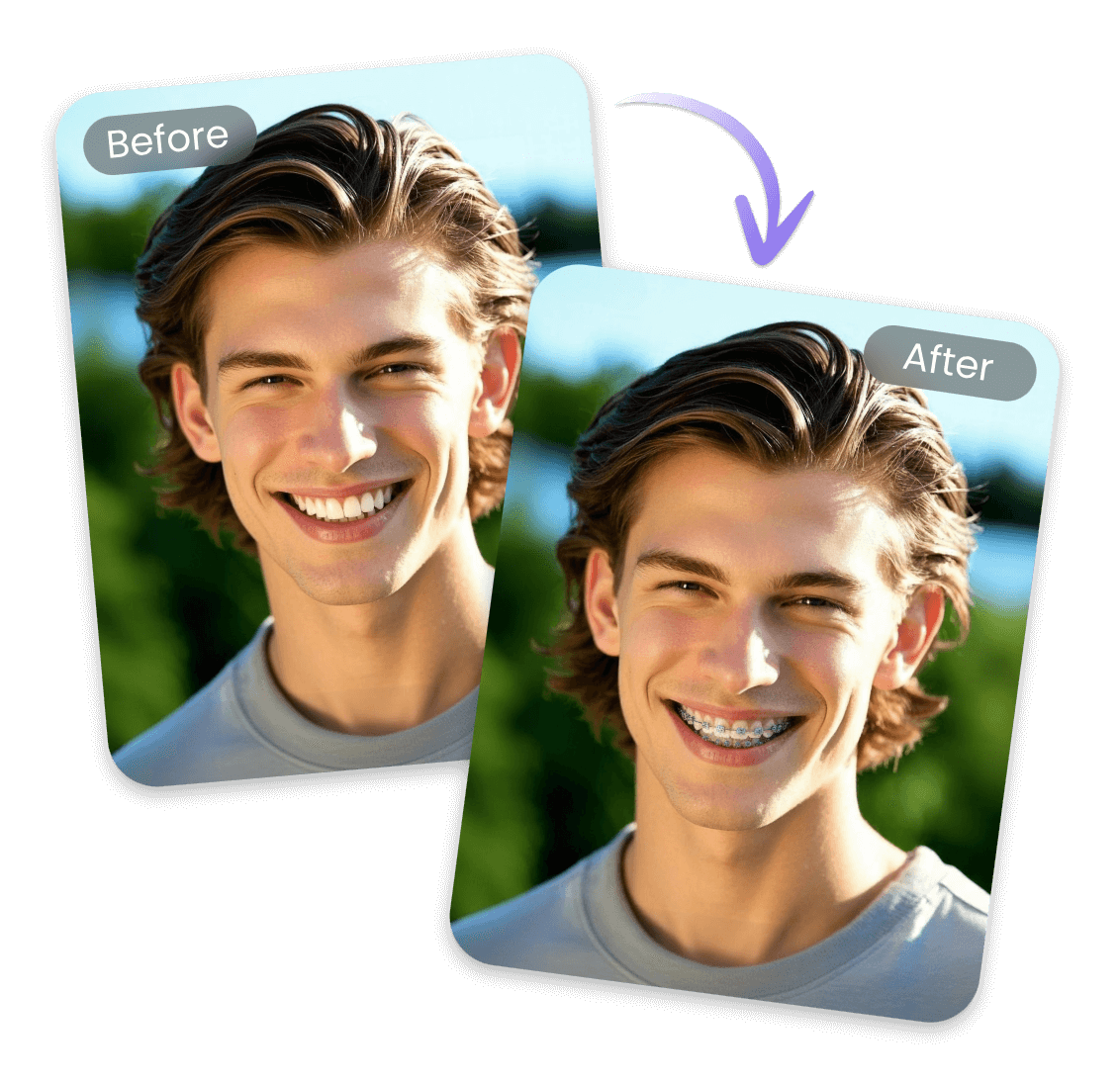 Upload your photo and preview braces instantly